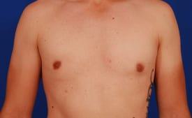 Patient Before & After Image