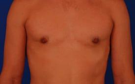 Patient Before & After Image