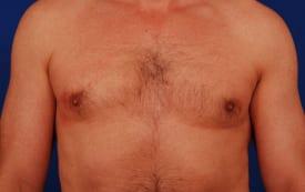 Patient Before & After Image