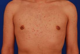 Patient Before & After Image