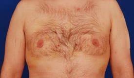 Patient Before & After Image