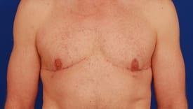 Patient Before & After Image