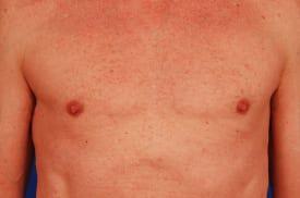 Patient Before & After Image