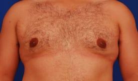 Patient Before & After Image