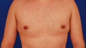 Patient Before & After Image