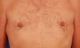 Patient Before & After Image