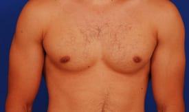 Patient Before & After Image