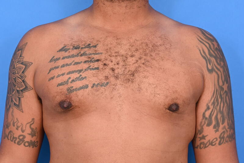 Patient Before & After Image