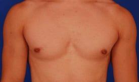 Patient Before & After Image