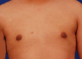 Patient Before & After Image