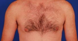 Patient Before & After Image