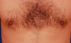 Patient Before & After Image