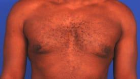 Patient Before & After Image