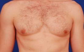 Patient Before & After Image