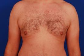 Patient Before & After Image