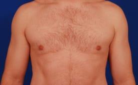 Patient Before & After Image