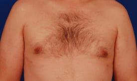 Patient Before & After Image