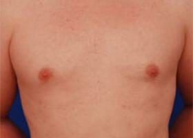 Patient Before & After Image