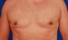 Patient Before & After Image