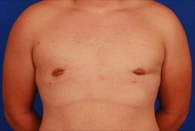 Patient Before & After Image