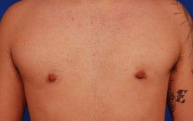 Patient Before & After Image