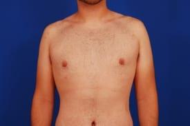 Patient Before & After Image