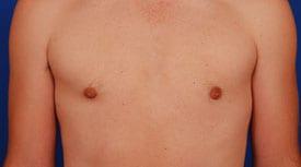 Patient Before & After Image