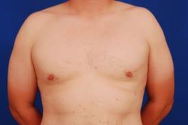 Patient Before & After Image