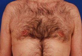 Patient Before & After Image