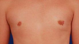 Patient Before & After Image