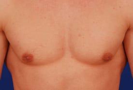 Patient Before & After Image