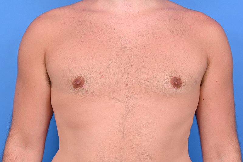 Patient Before & After Image