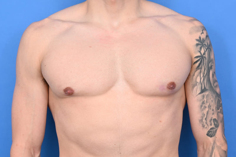 Patient Before & After Image