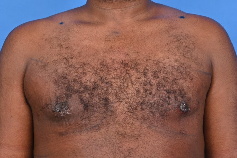 Patient Before & After Image