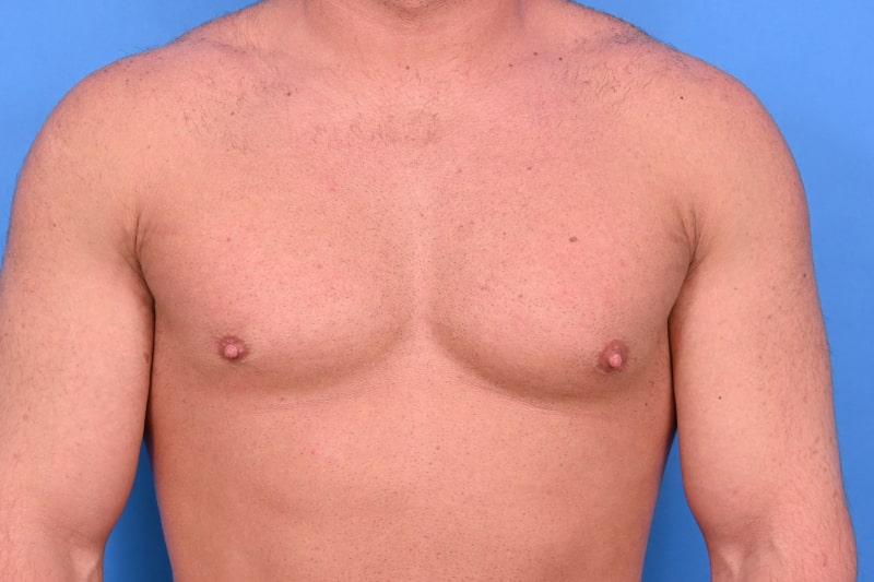 Patient Before & After Image