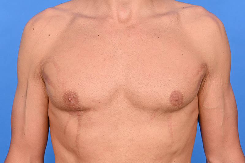 Patient Before & After Image