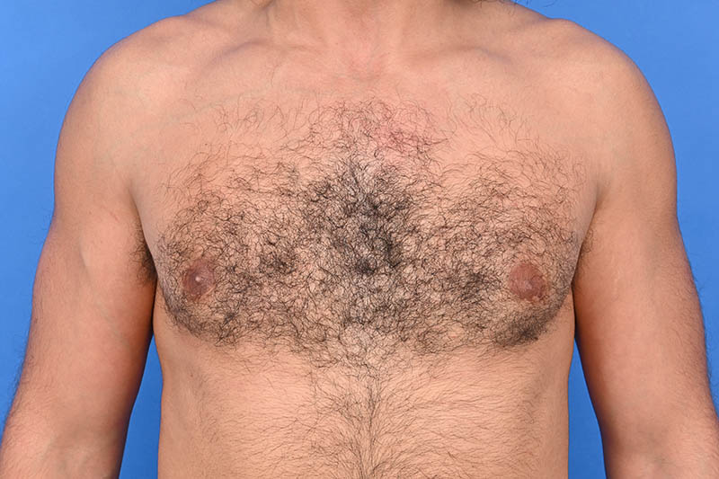 Patient Before & After Image