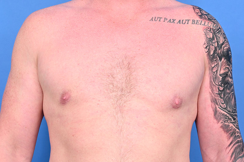 Patient Before & After Image