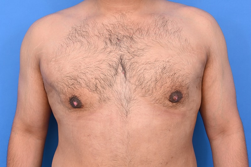 Patient Before & After Image