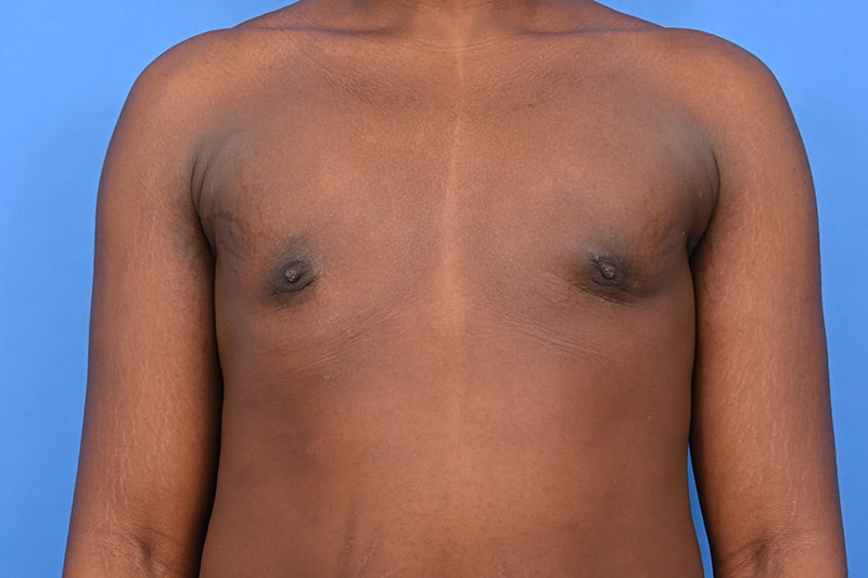 Patient Before & After Image