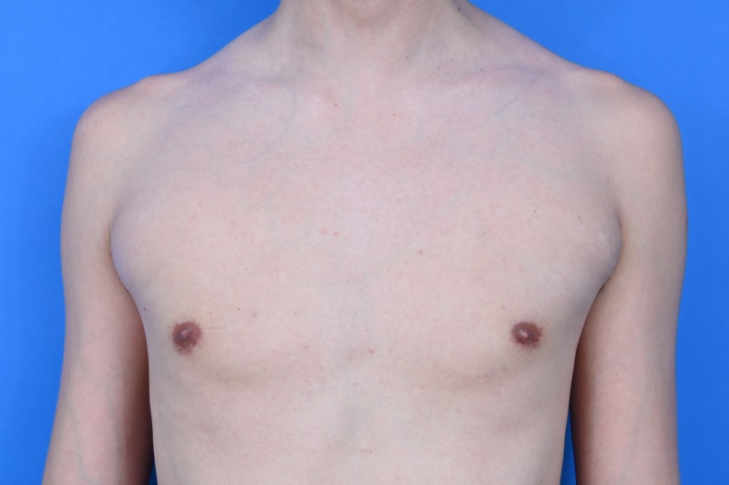 Patient Before & After Image