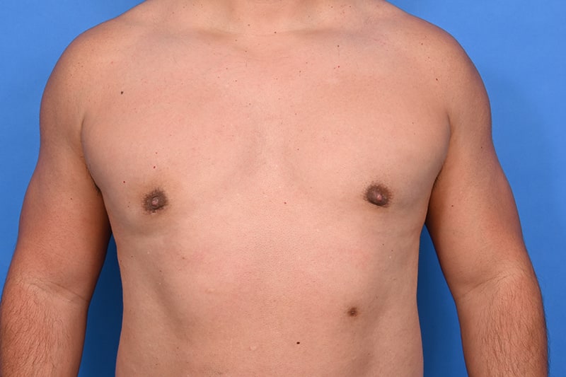 Patient Before & After Image