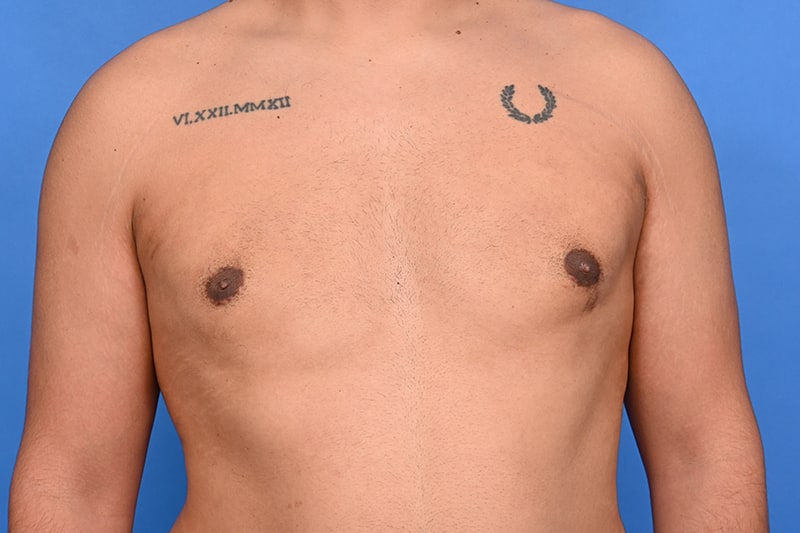 Patient Before & After Image