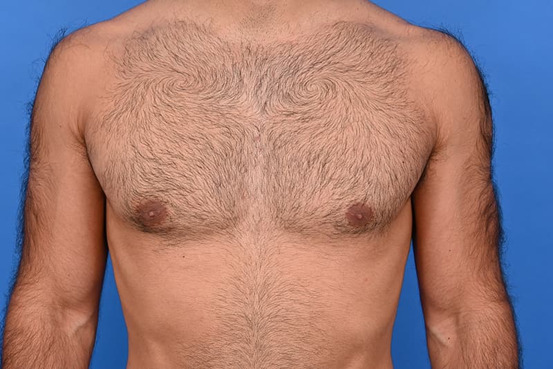 Patient Before & After Image