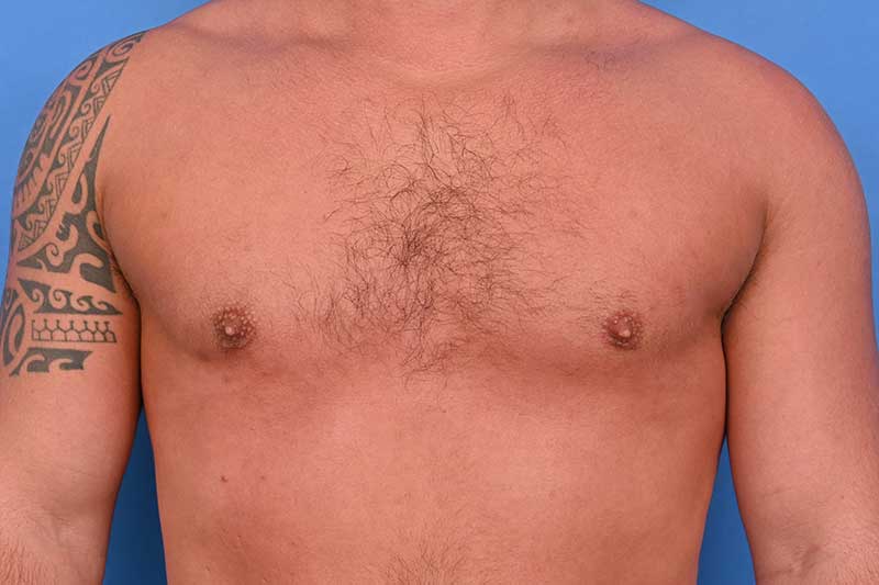 Patient Before & After Image