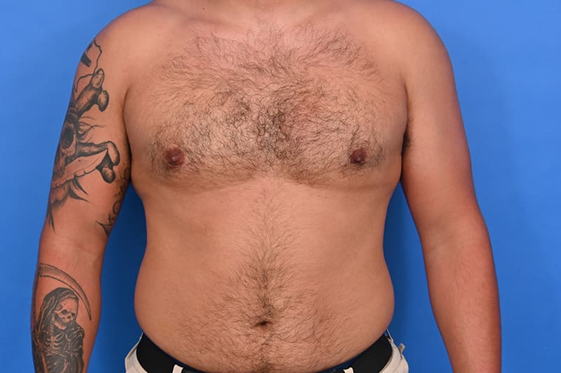 Patient Before & After Image