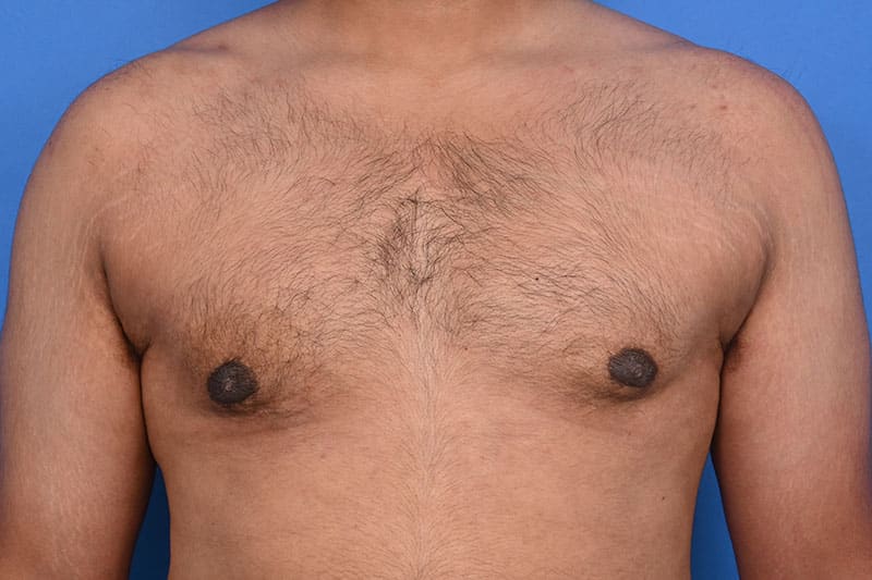 Patient Before & After Image