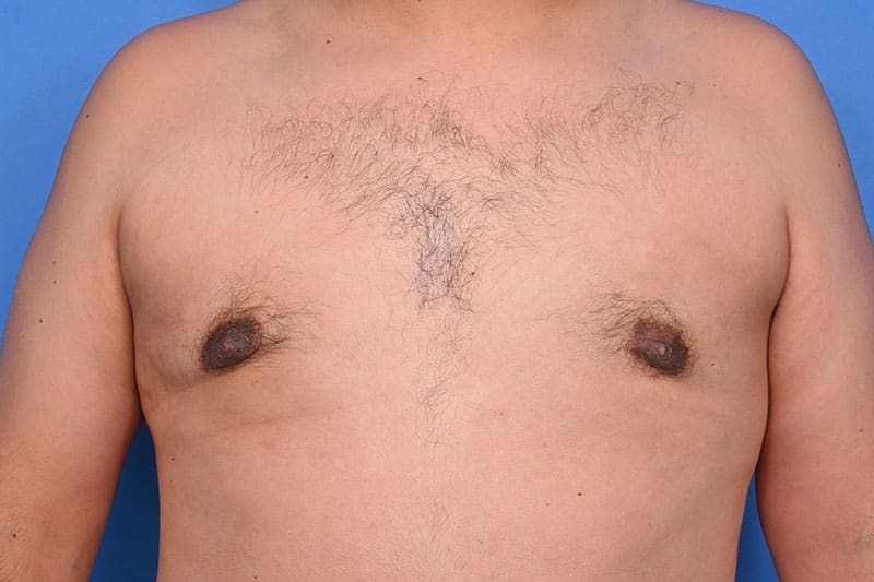 Patient Before & After Image