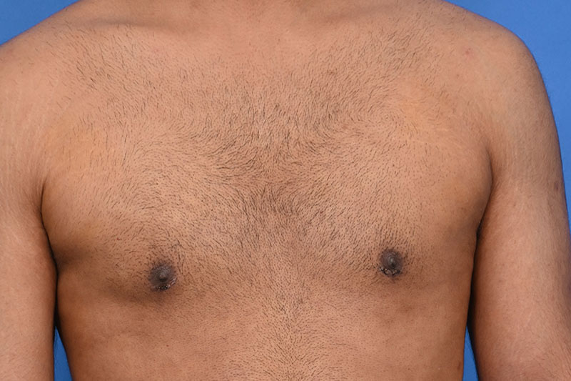 Patient Before & After Image