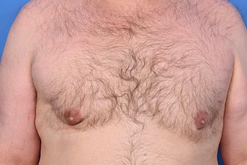 Patient Before & After Image